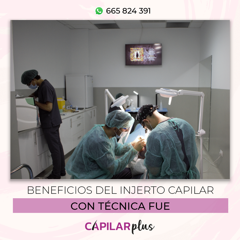 beneficios del injerto capilar con tecnica fue 