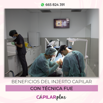 Beneficios del injerto capilar con tcnica FUE